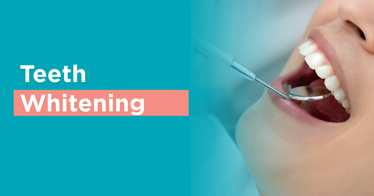 teeth whitening